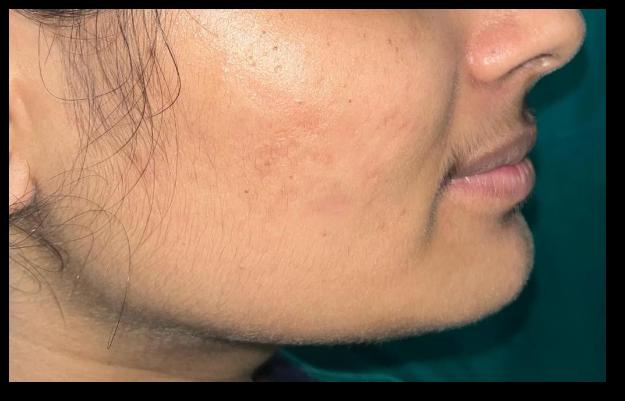 After