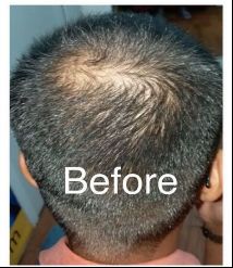Before