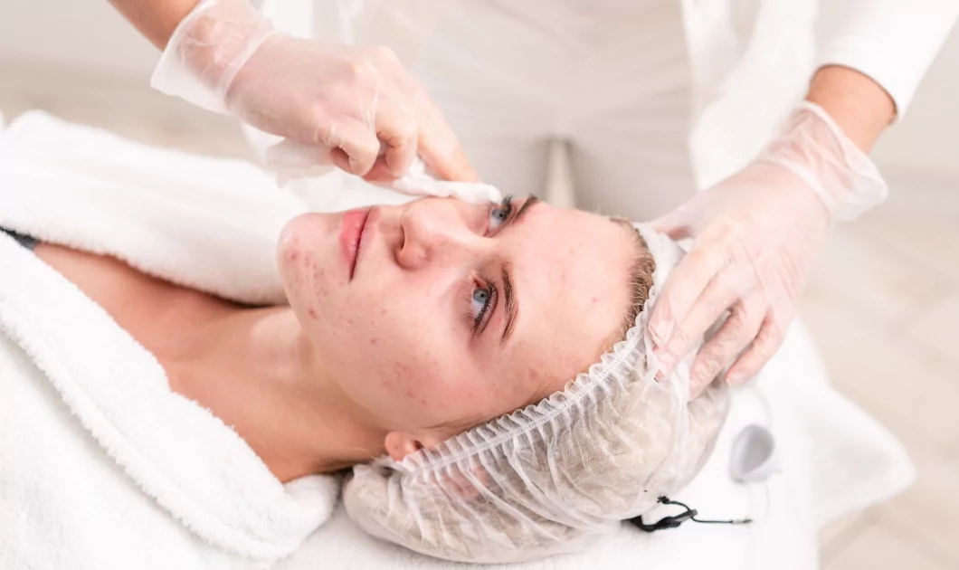 Skin Treatment